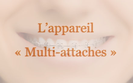 L'appareil « Multi-attaches »